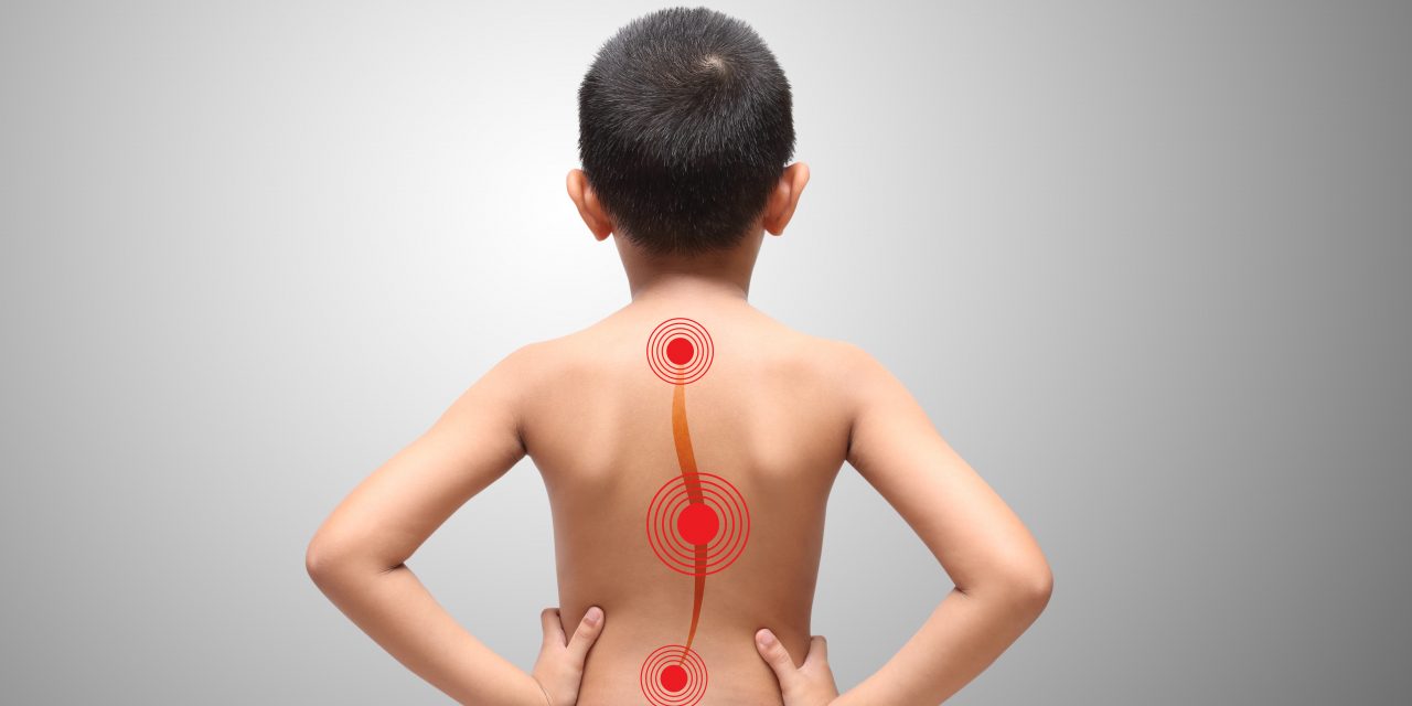Diagnóstico precoce é essencial para tratamento da escoliose